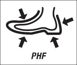 PHF® (Память пятки)