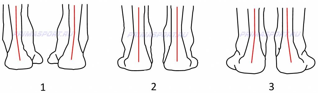 pronation_1.jpg